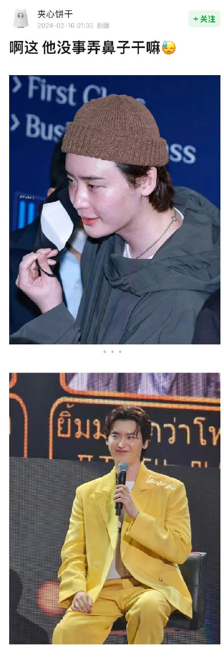 Li Zhongsheng's Cosmetic Surgery Transformation Sparks Outrage and Concern Among Fans